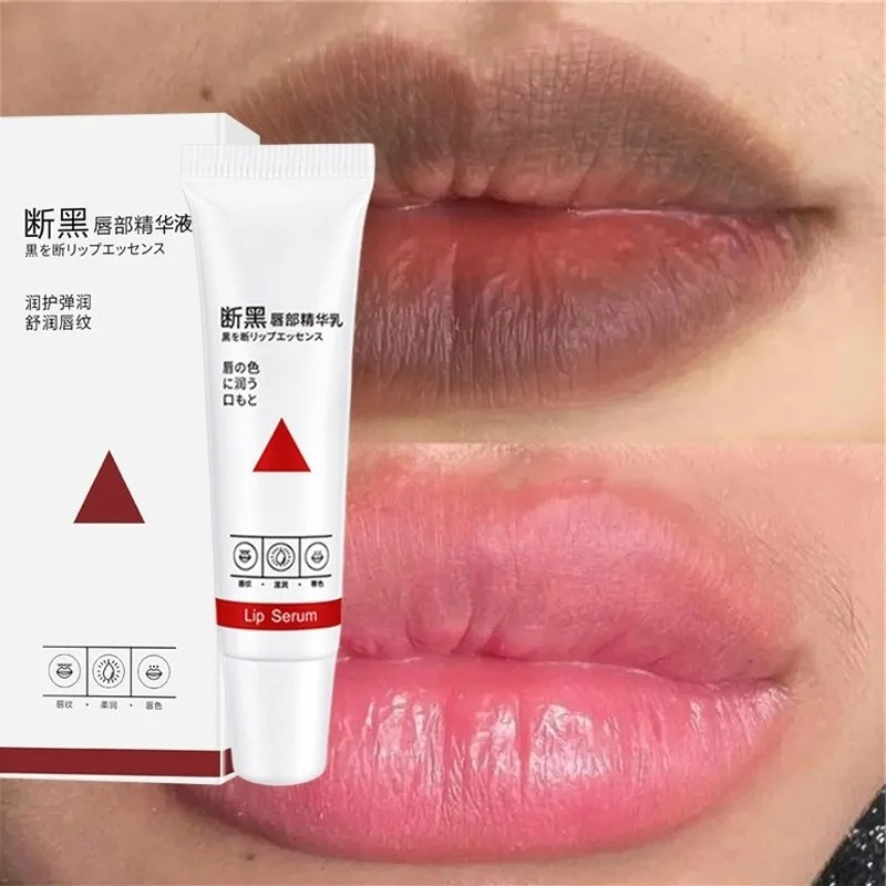 Remove Dark Lip Balm Fast Ligh - Korean Lifestyle Products 评论和价格