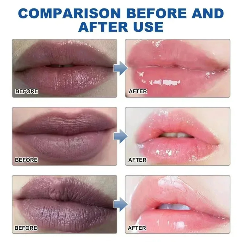 Remove Dark Lip Balm Fast Ligh - Korean Lifestyle Products 评论和价格