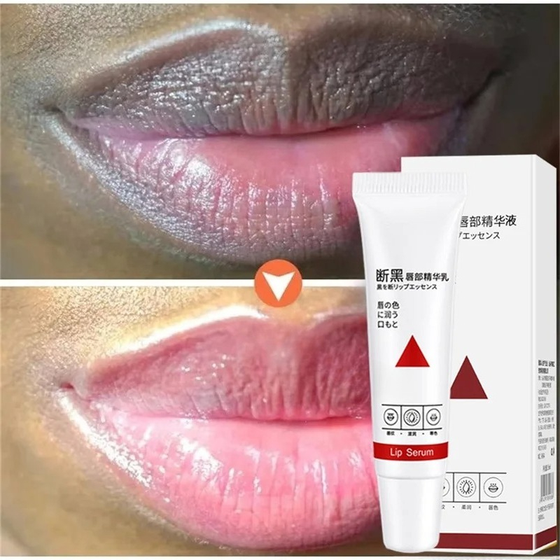 Remove Dark Lip Balm Fast Ligh - Korean Lifestyle Products 评论和价格