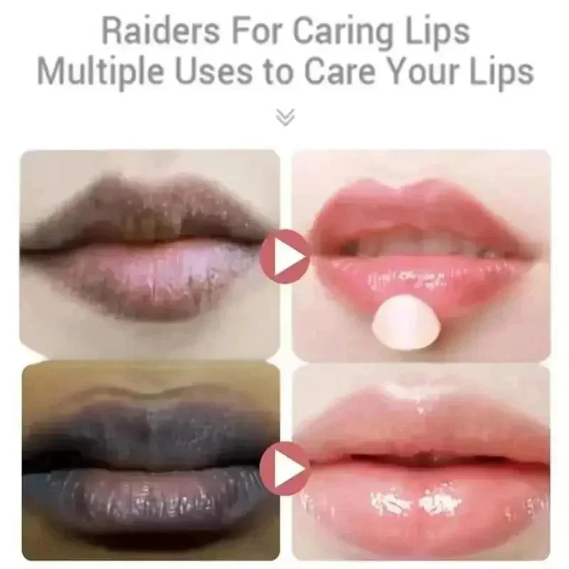 Remove Dark Lip Balm Fast Ligh - Korean Lifestyle Products 评论和价格