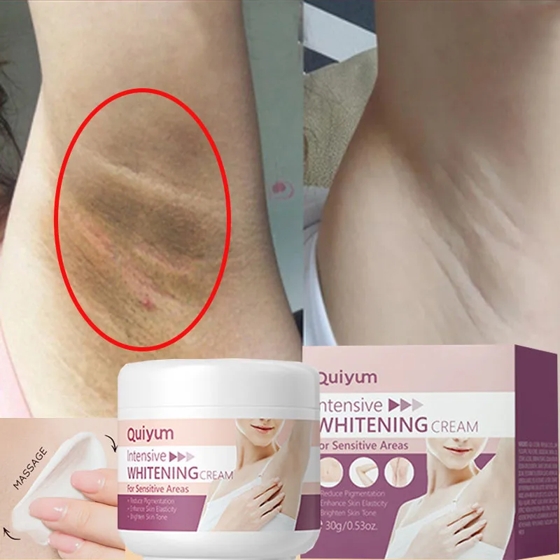 Whitening Cream For Dark Skin  - Korean Lifestyle Products 评论和价格