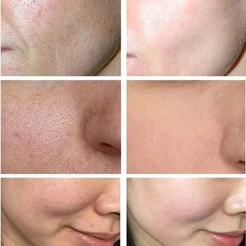 Salicylic Acid Pore Shrinking  - Korean Lifestyle Products 评论和价格