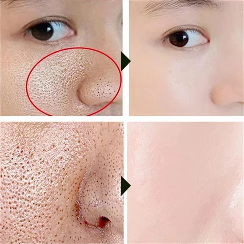Salicylic Acid Pore Shrinking  - Korean Lifestyle Products 评论和价格